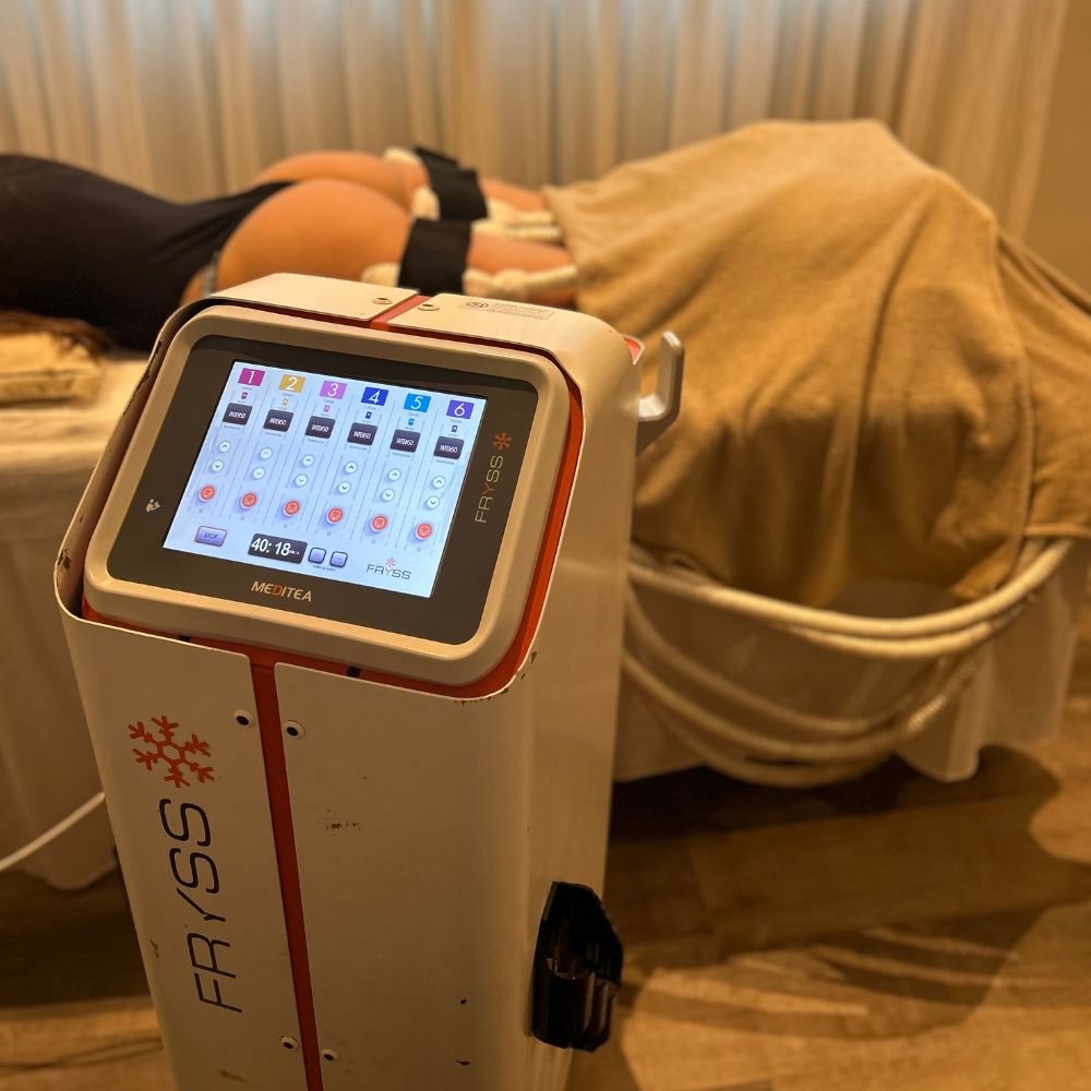 Criolipólisis Plana