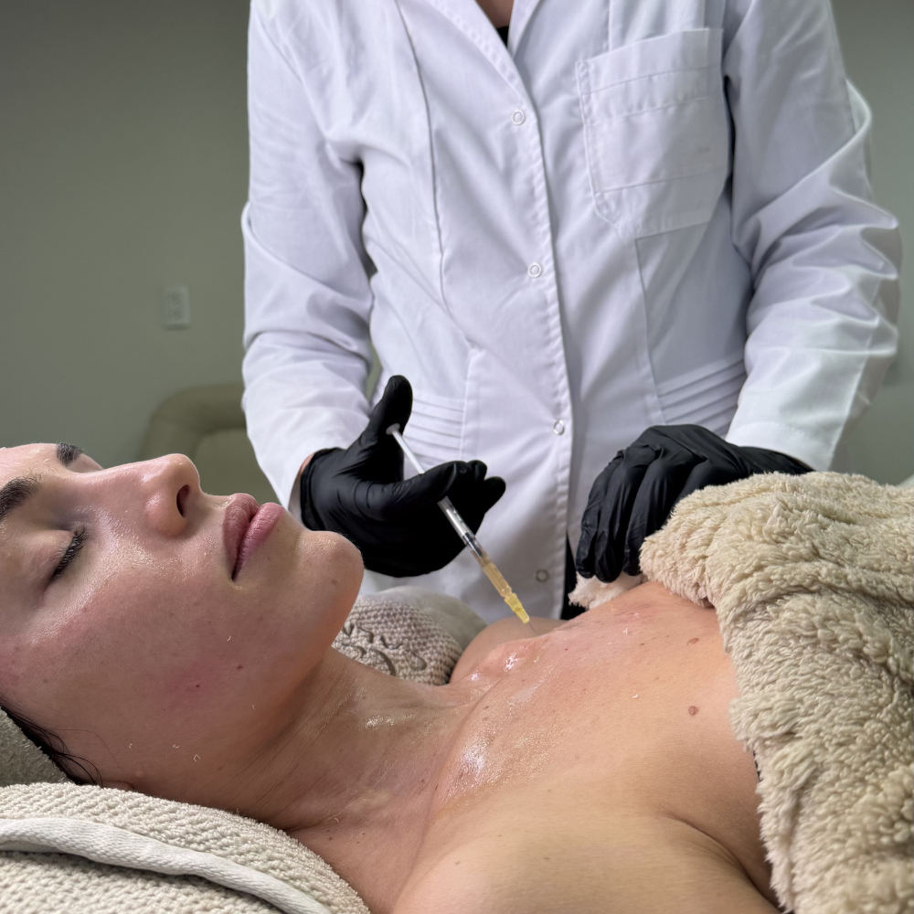 Plasma Rico en Plaquetas Facial